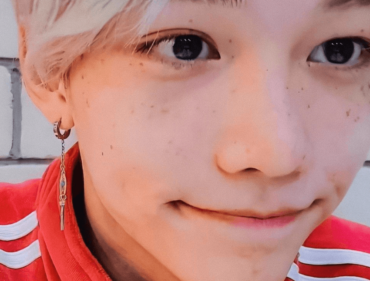 スキズ,フィリックス,そばかす