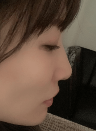 あいのり桃,顔変わった